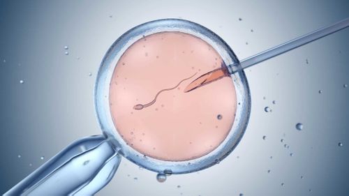 Bir çalışma IVF bebeklerinin sayısını ilk kez saydı.