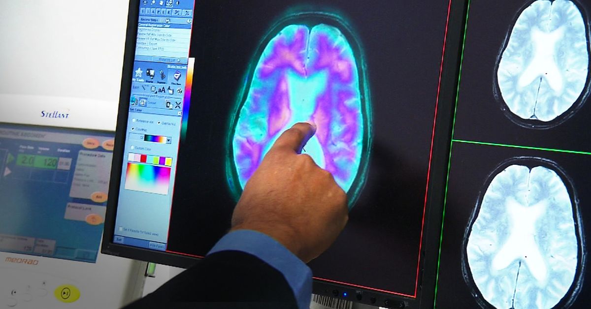 Australia now has a new leading cause of death