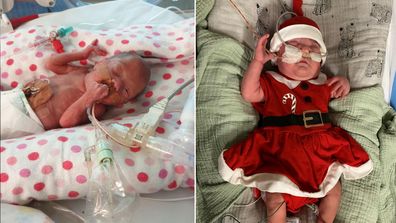 Moira was born at 23 weeks gestation weighing just 546 gms