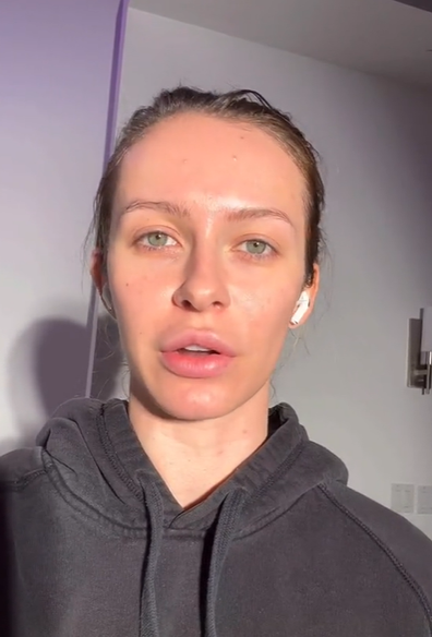 Model shows off her 'real' skin without photoshop