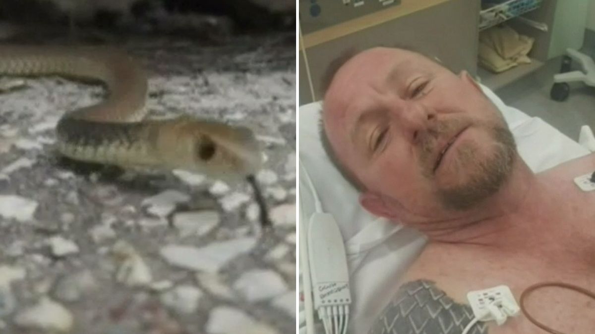 Snake Catcher's Harrowing Story Of Surviving A Brown Snake Bite