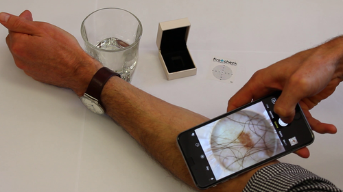 Firstcheck is the first ever skin cancer app allowing checks to be done in the comfort of your own home.