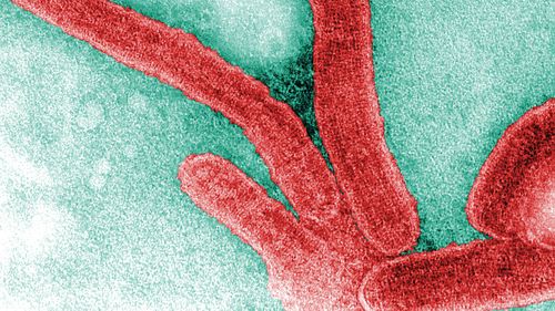 A colourised, negative stained transmission electron microscopic image of Marburg virus virions