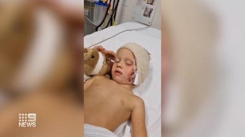Four-year-old Ace Elson from the Sunshine Coast had been visiting a property in Gympie with his family over the weekend when he was attacked by a dog.