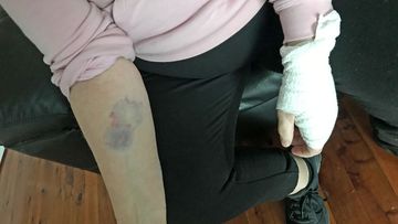 Dog owner Tina Aggio was also injured in the attack.