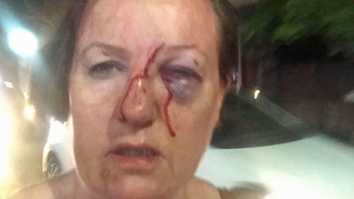 Brenda Graham was walking back to her Seminyak villa when she was attacked while filming a brawl.