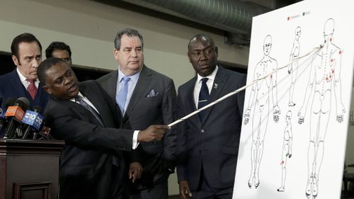 Pathologist Dr Bennett Omalu points to a diagram showing where police shooting victim Stephon Clark was struck with bullets. (AAP)