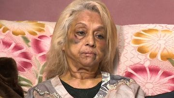 Ninette Simons is still bruised but is bravely sharing her story and pleading for help in finding her attackers, with the three men behind the incident still at large.