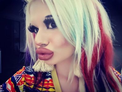 Andrea Emilova Ivanova aiming for the biggest lips in the world