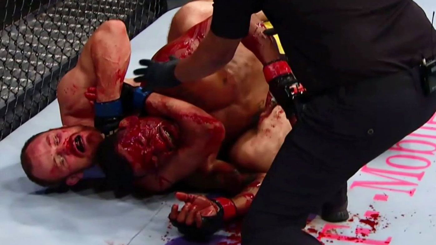 'That is a horror movie': Gunnar Nelson's bloodbath victory stuns fans at UFC 231