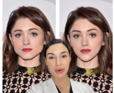 Cosmetic injector apologises for 'crazy' cosmetic suggestions made about Stranger Things star Natalia Dyer.