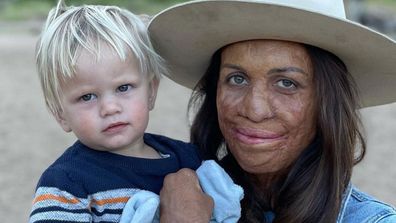 Turia Pitt and her second child, Rahiti