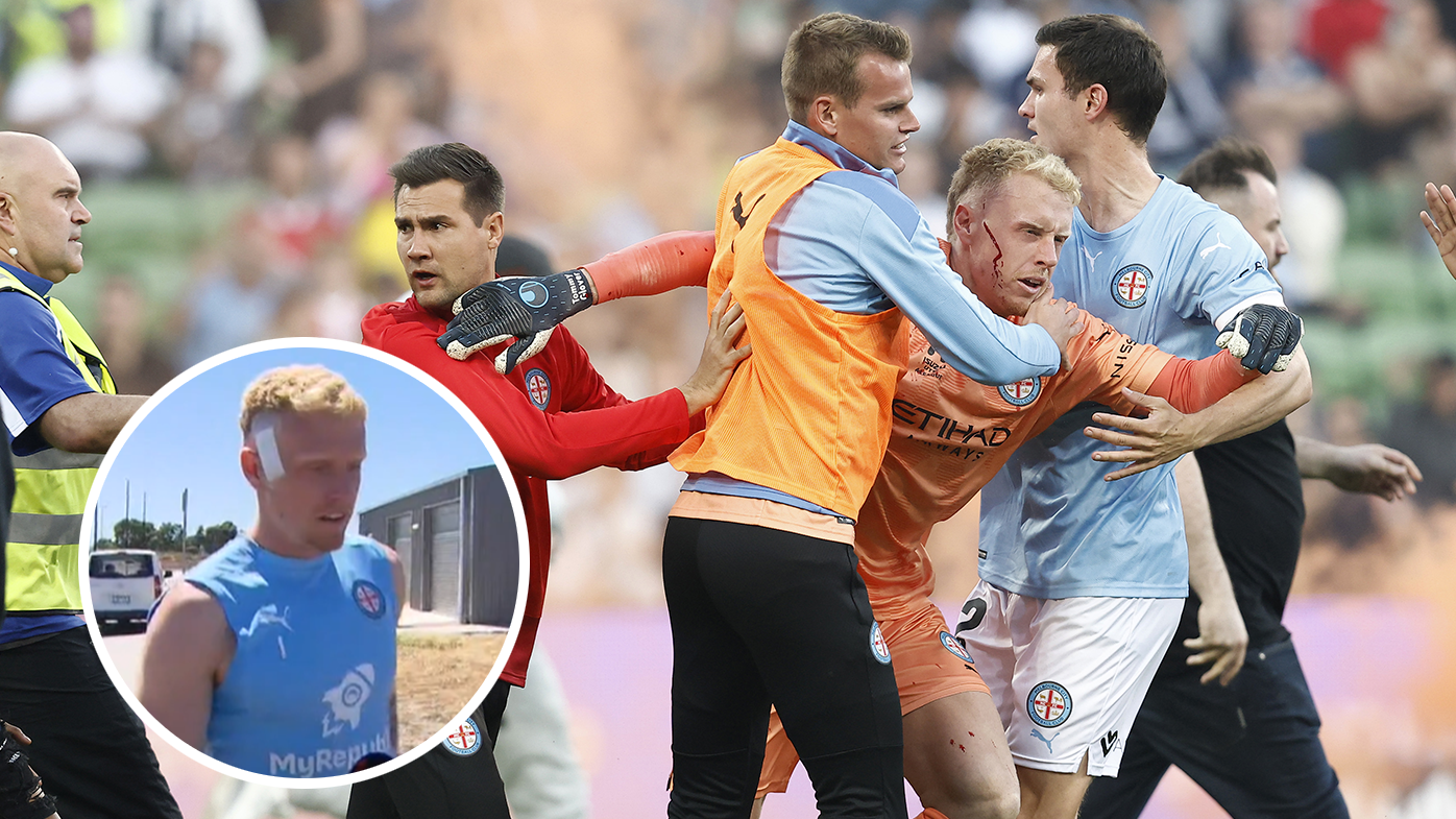 Injured Melbourne City goalkeeper Tom Glover breaks silence on 'disappointing' pitch invasion 