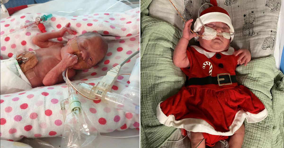 Birth Stories Brisbane Baby Born 17 Weeks Early A Christmas Miracle We Will Fight With Her 9honey