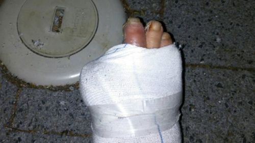 He thought he was going in to have an infected ulcer cleared when doctors decided his toe needed to be amputated. (Supplied)
