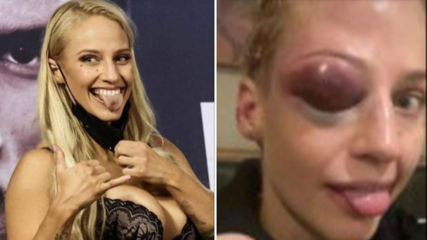 Australian boxing star Ebanie Bridges gives gruesome update on horror eye injury