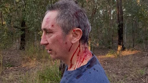 Pisasale opponent Jim Dodrill attacked in Ipswich bushland