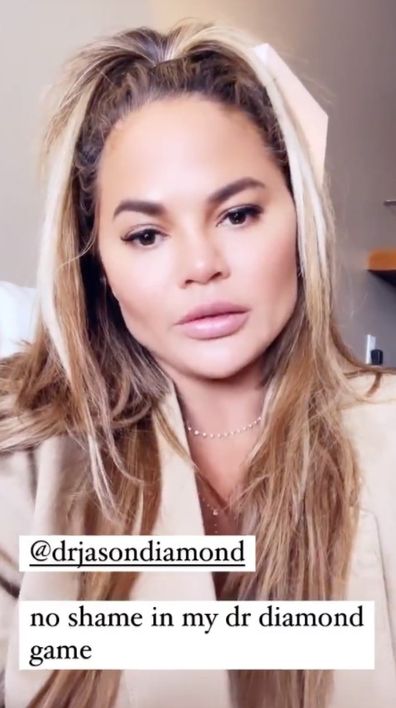 Chrissy Teigen reveals she got fat removed from her cheeks