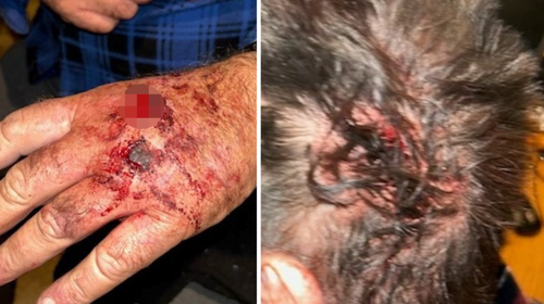 The man sustained lacerations to his head and hands and a broken finger during the ordeal.