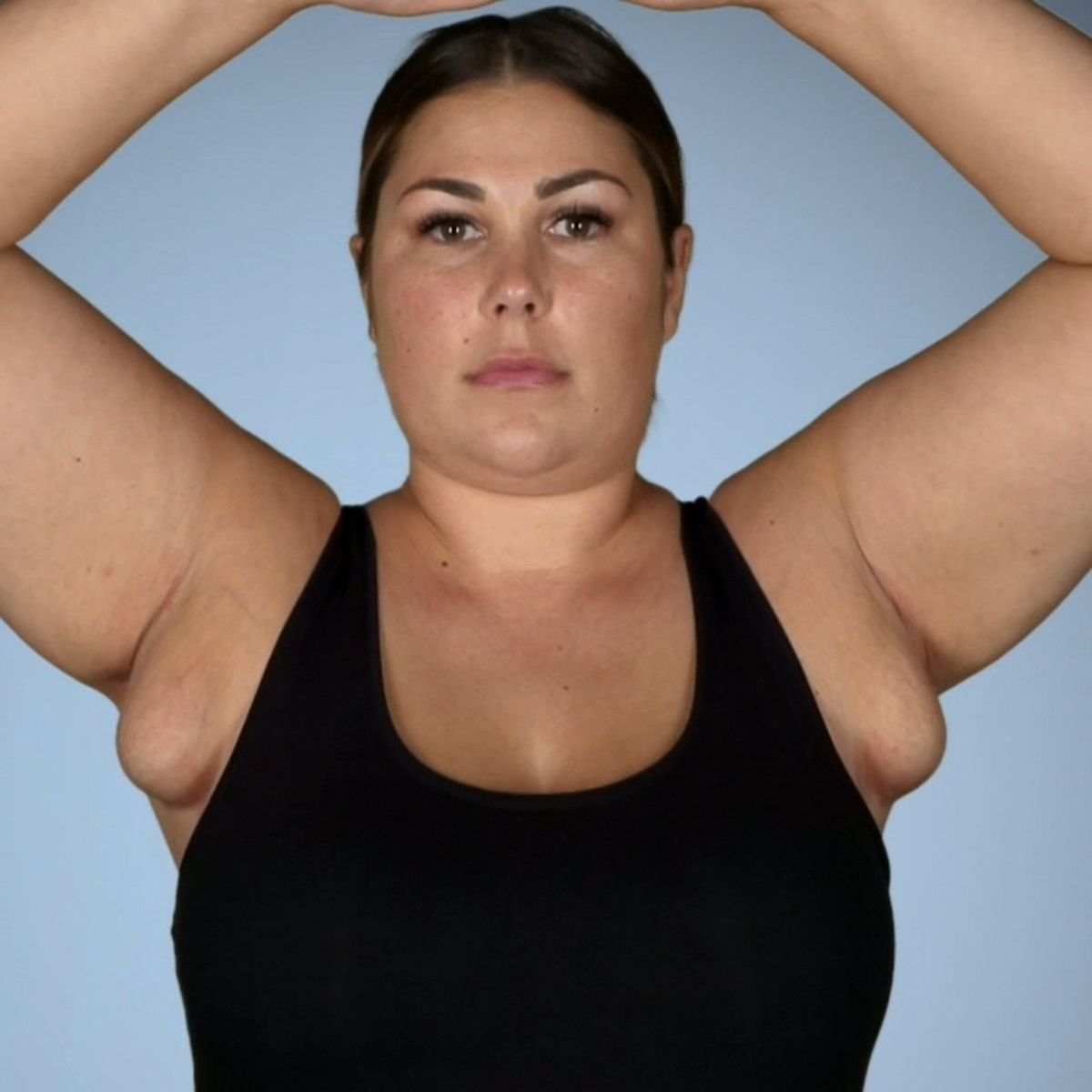 Botched: Woman with a second set of breasts in her armpits seeks help from  doctors - nine.com.au