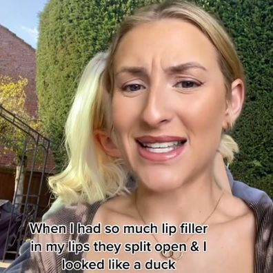 Woman's botched beauty filler