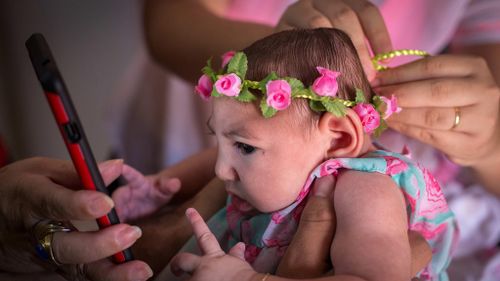 World Health Organisation will know if Zika virus causes microcephaly within weeks