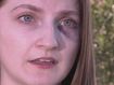 Breanna Coats was attacked while jogging.