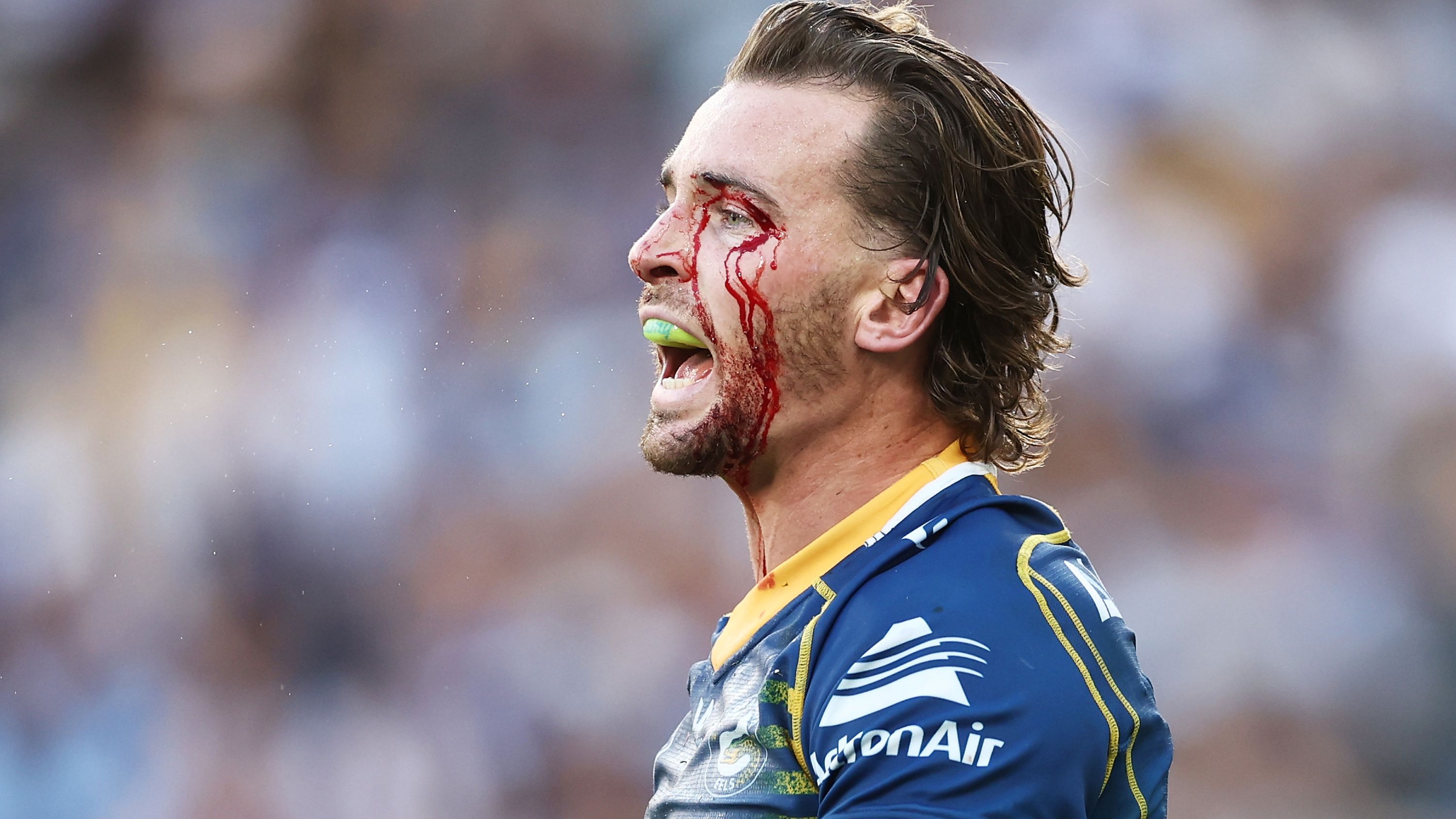 Clinton Gutherson of the Eels looks on with a facial cut during the round seven NRL match between Parramatta Eels and Canterbury Bulldogs at CommBank Stadium on April 16, 2023 in Sydney, Australia. (Photo by Matt King/Getty Images)