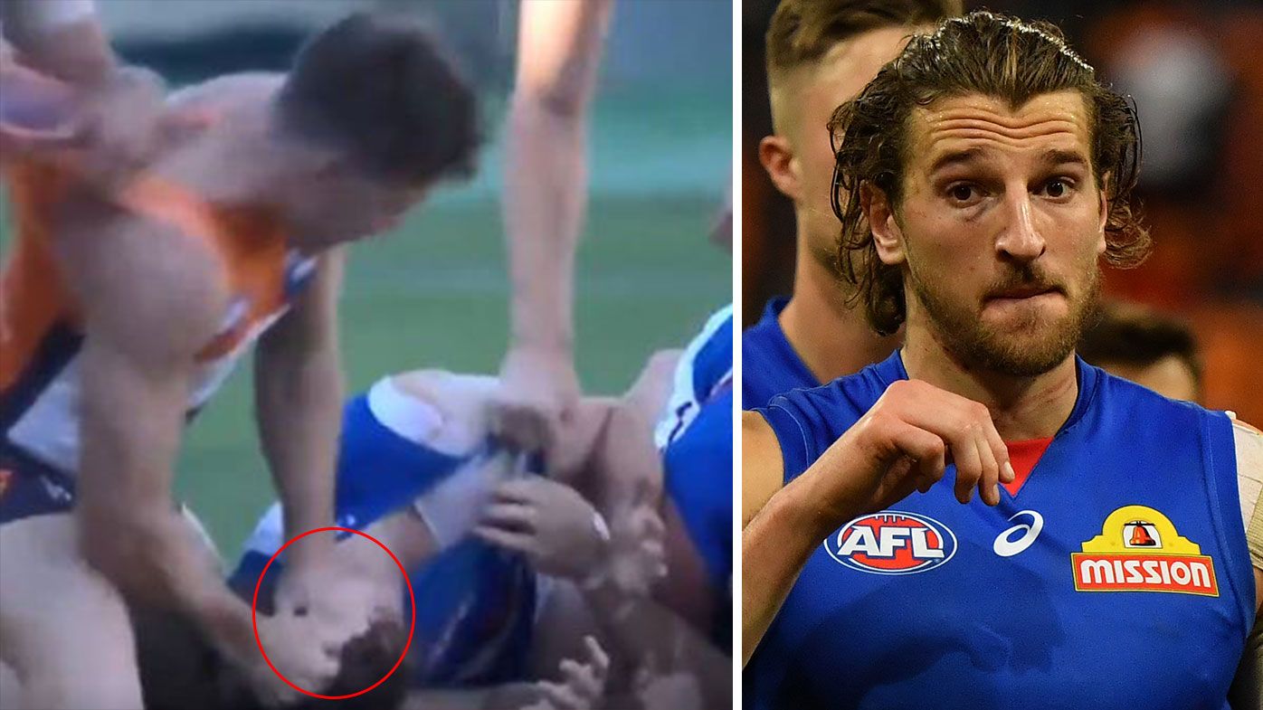 The Marcus Bontempelli photo that could end GWS star's finals campaign