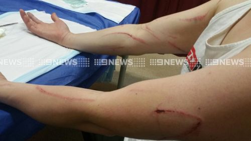 Mr Lewis suffered severe scratch marks from the attack. (9NEWS)