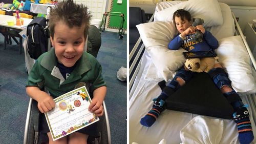 Before taking cannabis oil, Archer was having at least two seizures a day. 