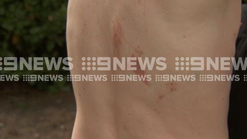 The victim suffered fractured ribs, along with cuts and bruises. (9NEWS)