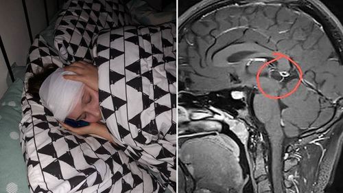 Amelia, 15, has a rare 10mm by 11mm pineal tumour at the centre of her brain that needs urgent surgery to remove. (Supplied)