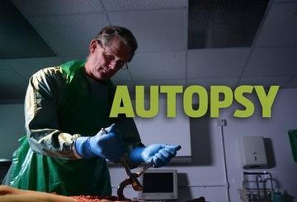 Autopsy