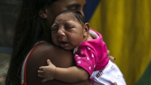 A baby with microcephaly, thought to be caused by Zika. (AFP file image)