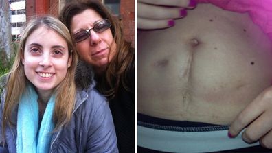 Jade May (left) was diagnosed with Crohn's disease when she was a teenager.