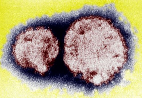 Hantavirus