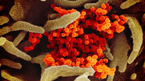 The Novel Coronavirus SARS-CoV-2, orange, emerging from the surface of cells, green, cultured in the lab. Also known as 2019-nCoV, the virus causes COVID-19. The sample was isolated from a patient in the United States.