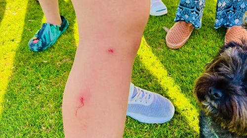 A Perth councillor is in a standoff with council over a mosquito and midge outbreak that is leaving children with bites at a popular park.