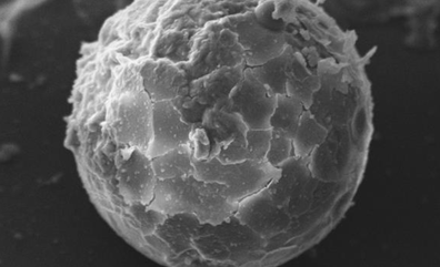 Pollen found in homes