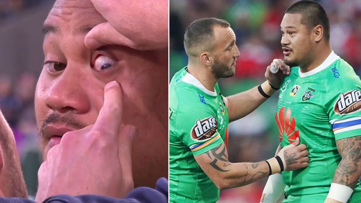 NRL investigate fireworks mishap after Canberra's Joseph Leilua suffers eye injury