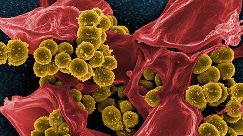 Antibiotic overuse warning as resistant superbug spreads into community