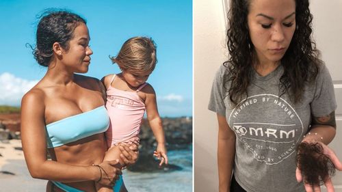 Ms Cooper and her daughter (left) and her experiencing hair loss as a result of her implants.