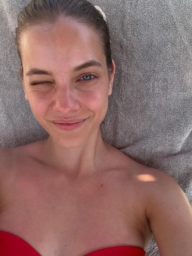 Barbara Palvin opens up about endometriosis in Instagram post