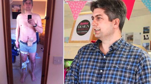 UK man shares colostomy bag selfie to raise awareness about prostate cancer