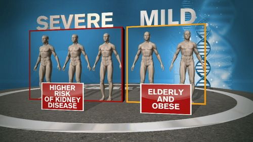 Research shows adult onset diabetes should be separate into five different groups (Supplied).