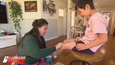 Jenny Lay's son, Atticus, is through the worst of his eczema.