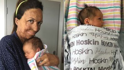 Turia Pitt has shared her birth stories with 9Honey Parenting