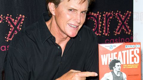 Bruce Jenner's face is scarily tight