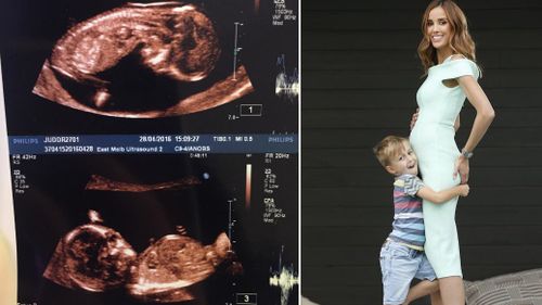 Rebecca Judd announces she is expecting identical twin boys